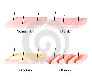 Normal, dry, oily, younger and older skin. sectional view