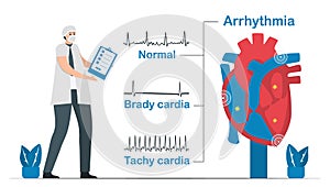 Normal heart signal is compared with 2 types of arrhythmia. It includes tachycardia and bradycardia. Cardiology vector