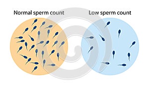 Normal and low sperm count