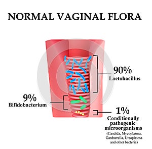 Normal microflora of the vagina. The ratio of lactobacilli, bifidobacteria and conditionally pathogenic bacteria. photo