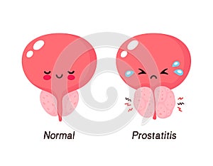 Normal prostate and benign prostatic hyperplasia