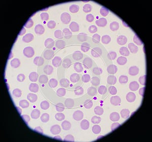 Normal red blood cells background