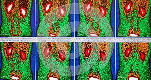 Normal renal flow in red/brown/green