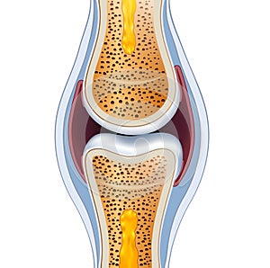 Normal synovial joint anatomy