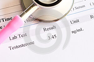 Normal testosterone hormone test result