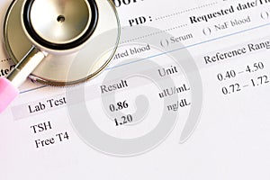 Normal thyroid hormone test result