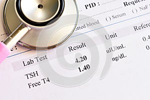 Normal thyroid hormone test result
