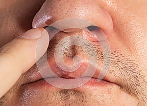 Nose of a man and a finger in his nose, picking his nose. Bad habit and psychological disorder rhinotillexomania, close-up