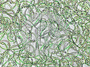 Nostoc sp. algae under microscopic view, cyanobacteria, blue green algae