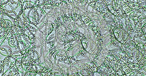 Nostoc sp. blue-green algae under microscopic view, cyanobacteria photo