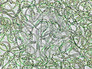 Nostoc sp. algae under microscopic view, cyanobacteria, blue green algae photo