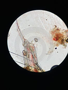 Notoedres cati under the microscope. Notoedric mange, also referred to as Feline scabies