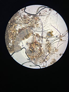 Notoedres cati under the microscope. Notoedric mange, also referred to as Feline scabies