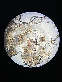 Notoedres cati under the microscope. Notoedric mange, also referred to as Feline scabies