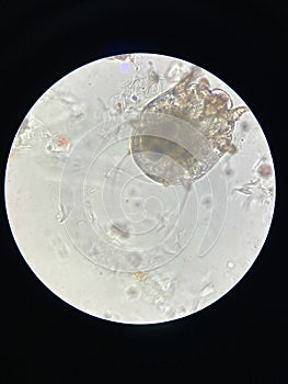 Notoedres cati under the microscope. Notoedric mange, also referred to as Feline scabies