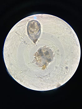 Notoedres cati under the microscope. Notoedric mange, also referred to as Feline scabies