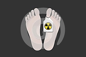 Nuclear radiation and irradation killed a human person