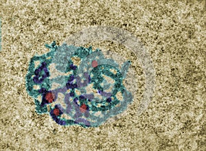 Nucleolus. False colour TEM micrograph