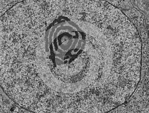 Nucleolus, TEM