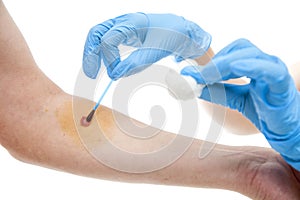 Nurse applying iodine