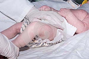 Nurse changing diaper of newborn baby in neonatal intensive care unit photo