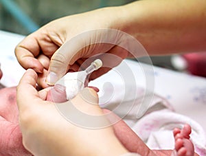 Nurse hands using medical adhesive plaster on sick newborn baby's hand safely for prepare fill the saline solution and medicine