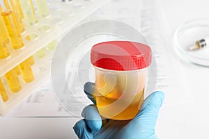 Nurse holding container with urine sample for analysis at table, closeup