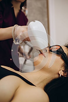 nurse makes the girl a upper lip laser hair removal procedure