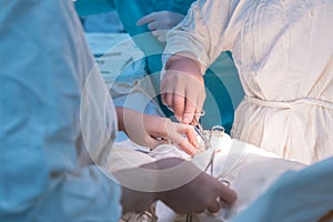 A nurse, in the operating room, gives tools to a pediatric surgeon during an operation for pediatric urology. Close-up