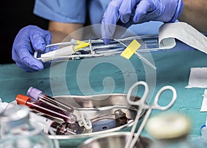 Nurse prepares Venous catheters of Long Duration in a hospital, Accessing Indwelling Central Venous Lines