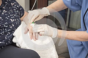 Nurse putting an IV needle into a patients hand