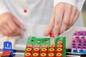 Nurse`s hands taking test tube