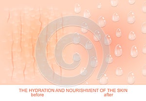 Nutrition and hydration of the skin