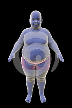 Obese boy, 3D illustration. Concept of obesity