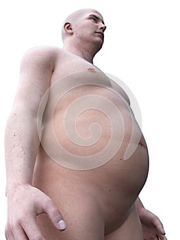 an obese male