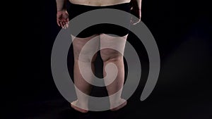 Obese male legs on dark background, health problems, insecurities, disease