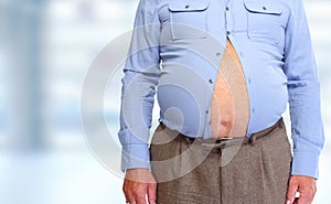 Obese man abdomen.