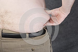 Obese Man Grabbing Fat On The Stomach