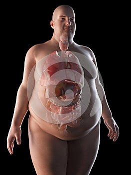 An obese manÂ´s organs