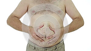 Obese man squeezing fat stomach