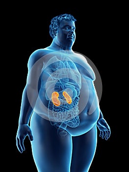 An obese mans kidneys