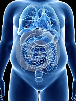 An obese mans organs