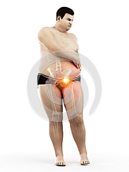 An obese mans painful hip joint