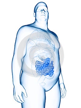 an obese mans small intestines