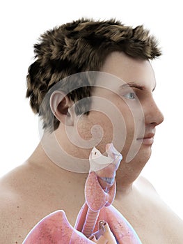 An obese mans throat anatomy