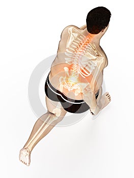 An obese runners painful back