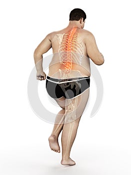 An obese runners painful back