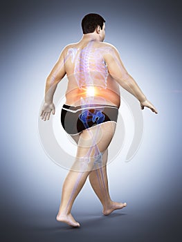 An obese runners painful back