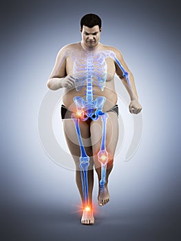 An obese runners painful joints