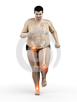 An obese runners painful joints